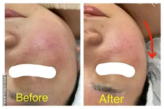 子宮矯正/腸揉み/ シュガーリング脱毛のエステ・リラクイメージ