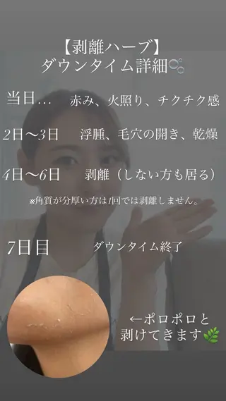 肌質改善ハーブ ピーリングBellaのエステ・リラクイメージ