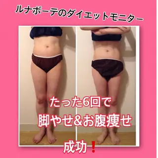 小尻・太もも痩せる エステルナボーテのエステ・リラクイメージ