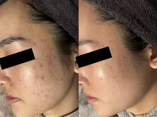 rejena 山口のエステ・リラクイメージ