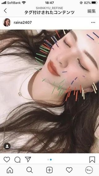 鍼灸整骨院Refine所属・鍼灸 Refineのその他イメージ