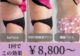 小顔矯正専門店 【RED】池田のエステ・リラクイメージ