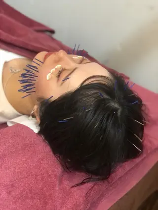 美容鍼灸女性専用 りんご鍼灸治療院のその他イメージ