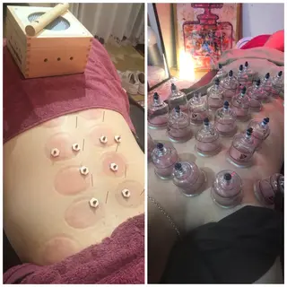 美容鍼灸女性専用 りんご鍼灸治療院のその他イメージ