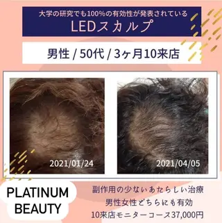 メンズ プラチナムビューティー柏所属・【歯科提携】柏ホワイ トニングスタイルのその他イメージ