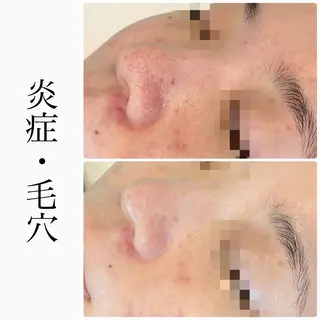 ハーブピーリング専門 BIOEL横浜のエステ・リラクイメージ