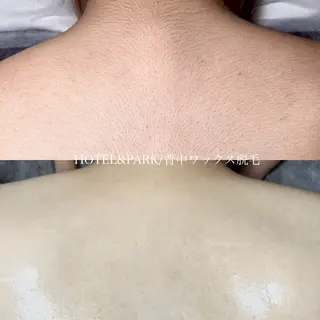 HOTEL&PARK .Moeワックス脱毛のエステ・リラクイメージ