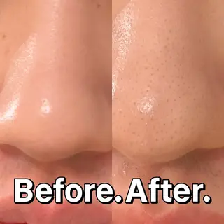 【ハイパーナイフ痩身&小顔コルギ&ハーブピーリング】K-Beauty　東新宿所属・kーbeauty痩身 フェイシャルのエステ・リラクイメージ