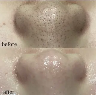 DahliaBeauty ダリアビューティー所属・DahliaBeau tyフェイシャル中村のその他イメージ