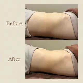 お腹痩せエステ Flat BELLY 恵比寿所属・【腸もみ/脂肪冷却】 お腹エステ/恵比寿のエステ・リラクイメージ