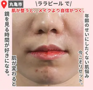 【LEPUS】 sekiのエステ・リラクイメージ