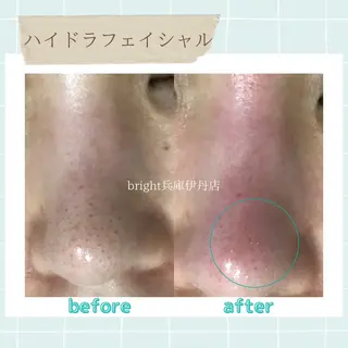 メンズ お手軽ホワイトニングsalon mina所属・武元 奈津美のエステ・リラクイメージ