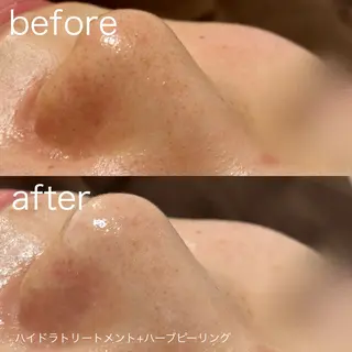 lulularico Yuのエステ・リラクイメージ