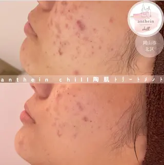 アンテインチル 山本のエステ・リラクイメージ