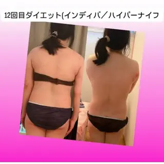 【ハイパーナイフ痩身&小顔コルギ&ハーブピーリング】K-Beauty　東新宿所属・kーbeauty痩身 フェイシャルのエステ・リラクイメージ