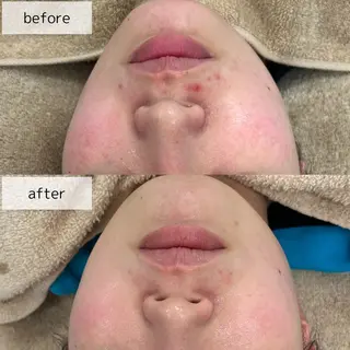 Venus所属・エステサロン Venusのエステ・リラクイメージ