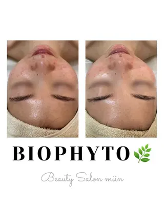 韓国肌管理 白玉肌管理®︎のエステ・リラクイメージ