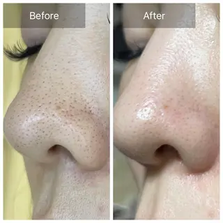 バフトアップ/ハーブ Nornのエステ・リラクイメージ