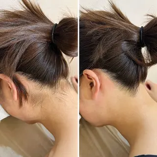 うなじ脱毛/美肌脱毛 LABELのエステ・リラクイメージ