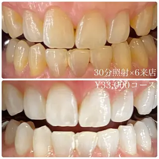 メンズ ホワイトニングルーム　川崎店所属・ホワイトニング ルーム　川崎店のその他イメージ