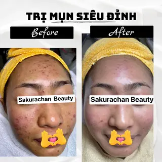 ニキビ、痩身、脱毛、 サクラチャンスパのエステ・リラクイメージ