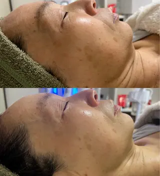 Beauty   Salon  Adiy所属・Adiy ikumiのエステ・リラクイメージ