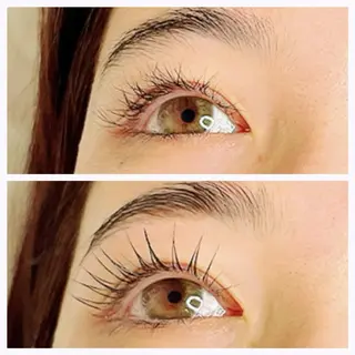 マツエク・マツパ sprinkles loungeのエステ・リラクイメージ