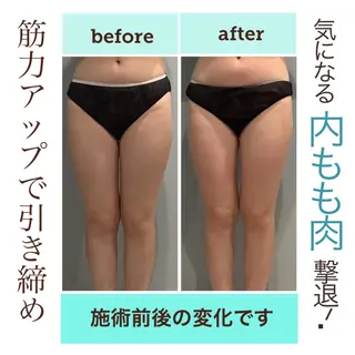 エステサロン JURISのエステ・リラクイメージ