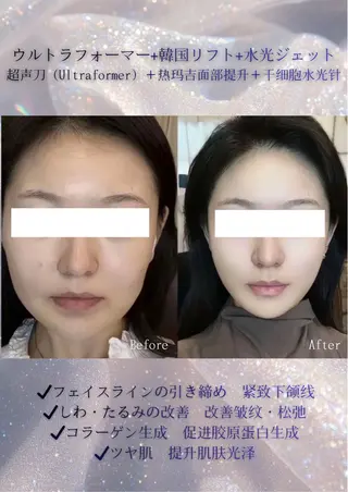 カラー aliaハイフ&水光ジェットサロン所属・aliaハーブ水光店 エステティシャン募集のエステ・リラクイメージ