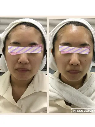 DeI'm   名古屋栄所属・小林 玲菜のエステ・リラクイメージ