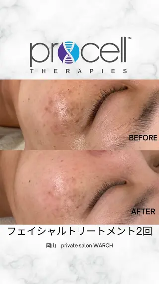 WARCH Marieのその他イメージ