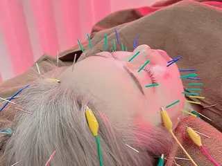 Spring鍼灸院所属・Spring鍼灸院 ✨首肩こり、腰痛に！のエステ・リラクイメージ