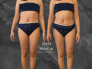 RENATA🕊 脂肪冷却専門店六本木のエステ・リラクイメージ