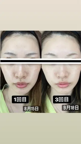 プラチナムビューティー柏所属・【歯科提携】柏ホワイ トニングスタイルのその他イメージ