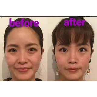 隆鼻矯正専門店ラプリ 佐藤のエステ・リラクイメージ