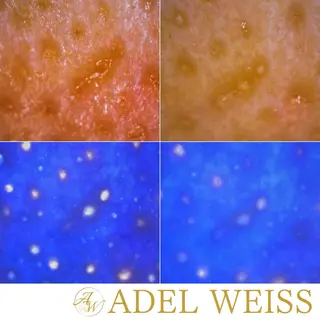 毛穴ケア＆脱毛サロン　ADEL WEISS所属・毛穴ケア＆脱毛サロン ADEL　WEISSのエステ・リラクイメージ