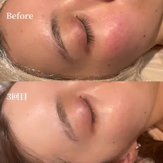 /ulu  soin所属・太田 玲奈のエステ・リラクイメージ