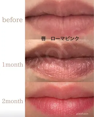 川越ローマピンク 光脱毛＆ワックス脱毛のエステ・リラクイメージ