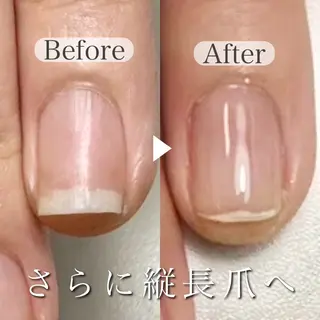 ネイル 深爪専門店 サロンリリーのネイルデザイン