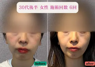 美容とカラダの鍼灸 サロン やなけんのその他イメージ