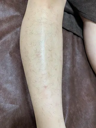 メンズ キッズ 脱毛SALON RaYNiCKのエステ・リラクイメージ