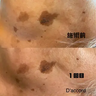 D’accord Rikoのネイルデザイン