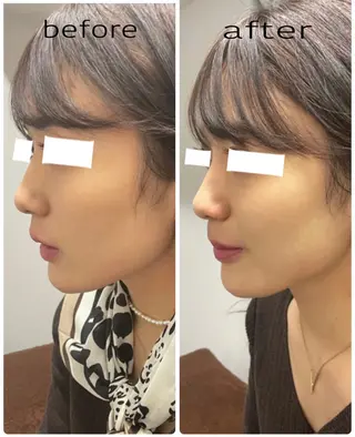 ENCHANT 脱毛.小顔.毛穴のエステ・リラクイメージ