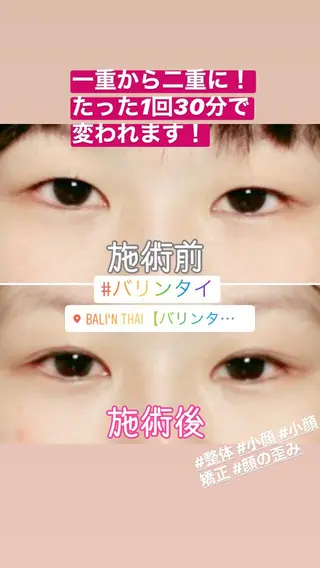 🌈歪み改善🌈 バリンタイ すぎうらのエステ・リラクイメージ