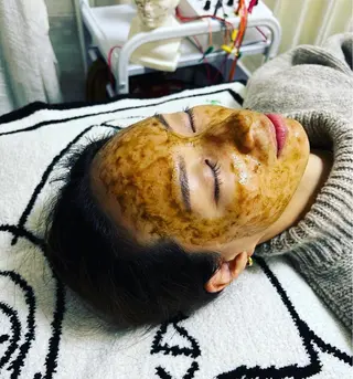 美容鍼灸サロン mahoroba院長のエステ・リラクイメージ