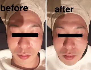 食べながら魅せボディ éclatJua川越のエステ・リラクイメージ