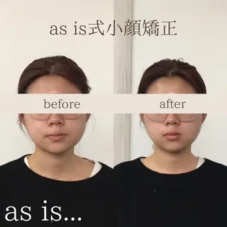 小顔専門アズイズ ビューティー　草津店のエステ・リラクイメージ