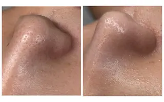 Salon【yuzu.】所属・肌管理×美眉 【yuzu.】のその他イメージ