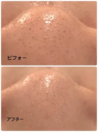 お肌と歯のサロン　Sona Mior所属・藤井 ののみのその他イメージ