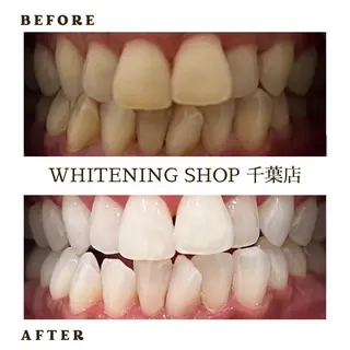 メンズ ホワイトニング ショップ千葉店のその他イメージ